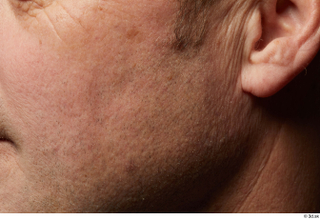 HD Skin Jake Perry cheek ear face skin pores skin…